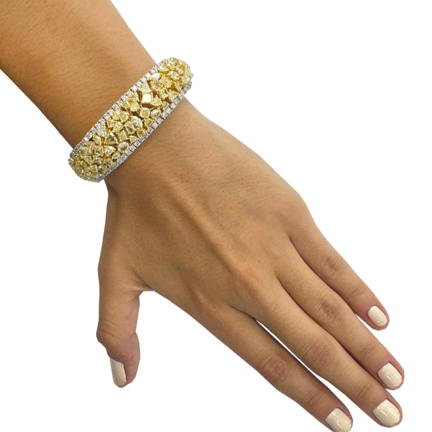 Elegant display of the VIVID 23Ct Fancy Yellow Diamond Bracelet in 18K Yellow & White Gold by Vivid Diamonds worn on a wrist, showcasing luxury and craftsmanship with radiant yellow and white diamonds.