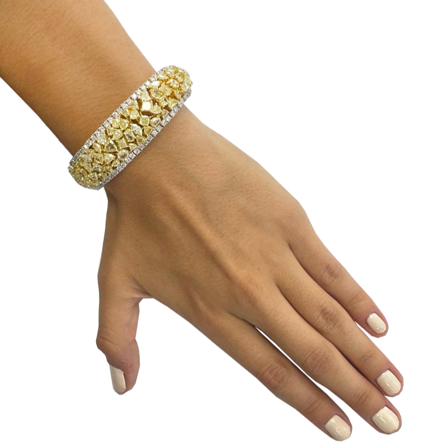 Elegant display of the VIVID 23Ct Fancy Yellow Diamond Bracelet in 18K Yellow & White Gold by Vivid Diamonds worn on a wrist, showcasing luxury and craftsmanship with radiant yellow and white diamonds.
